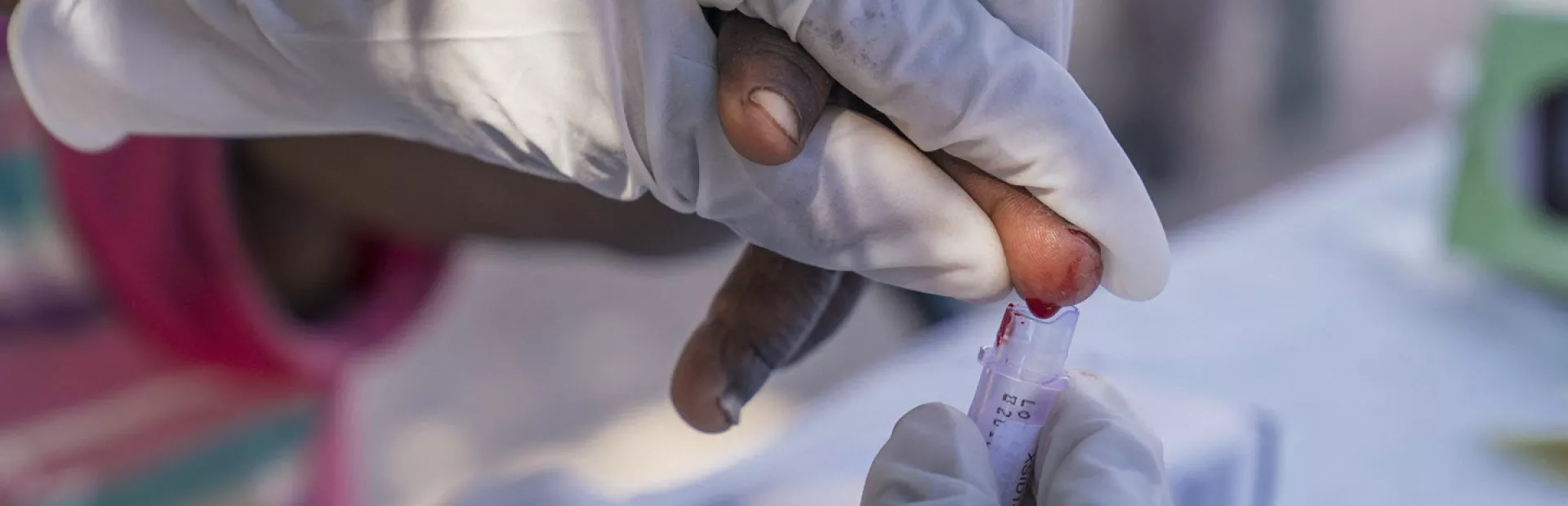 Testing of a child for malaria in Namibia by taking blood from the child's finger tip
