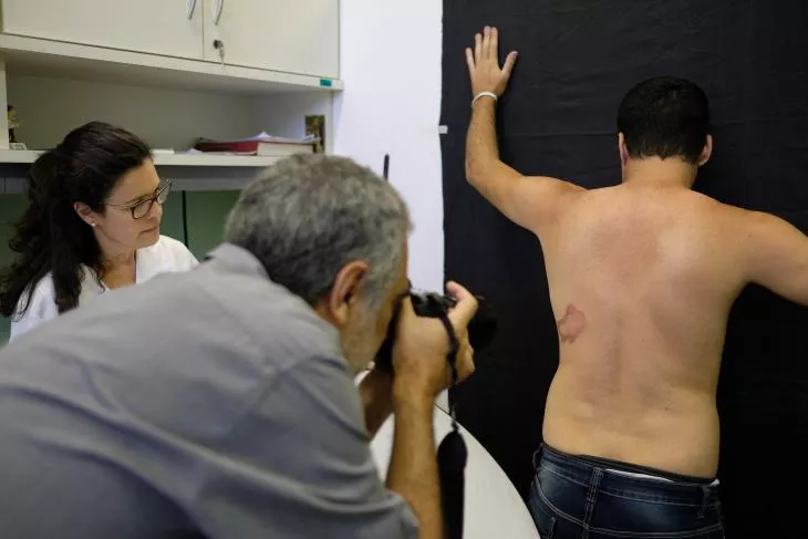 A photographer is taking a photo of the back of a patient for AI-enabled leprosy detection